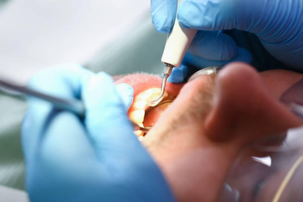 Best Same-Day Emergency Dental Services in Smithfield, VA