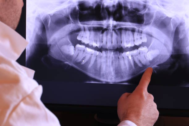 Best Emergency TMJ Treatment in Smithfield, VA