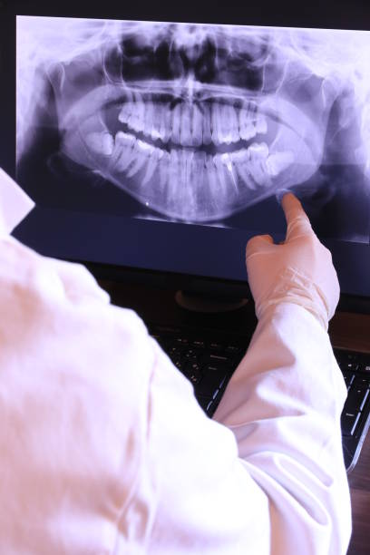 Best Emergency Treatment for Dental Infections or Abscesses in Smithfield, VA