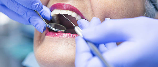 Best Emergency Treatment for Dental Infections or Abscesses in Smithfield, VA